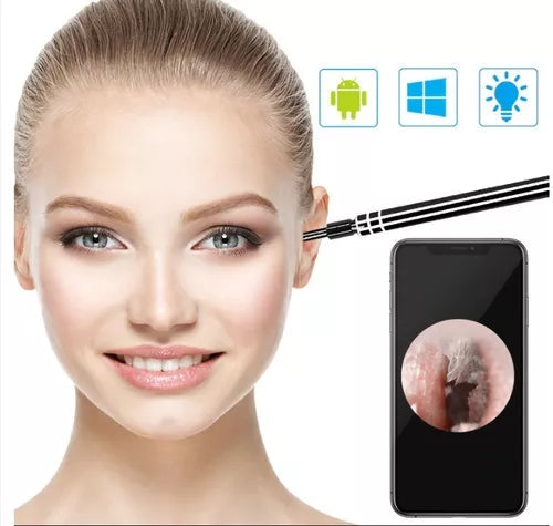 EarClear™ LIMPIADOR DE OIDOS CON CAMARA HD